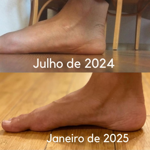 consertando o pé (3)