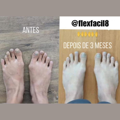 consertando o pé