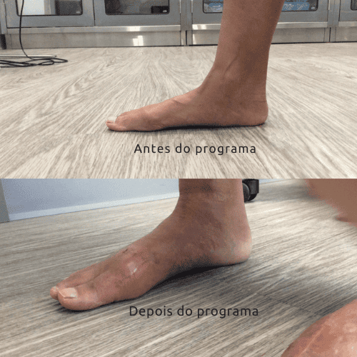 consertando o pé (9) (1)